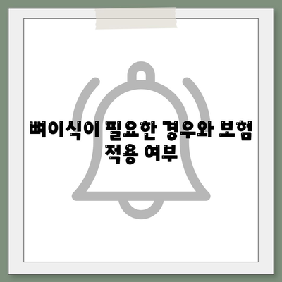 대전시 서구 복수동 임플란트 가격 | 비용 | 부작용 | 기간 | 종류 | 뼈이식 | 보험 | 2024