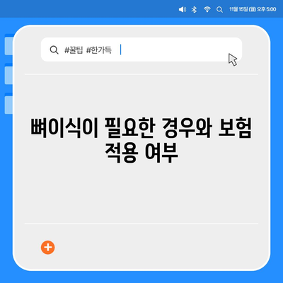 강원도 평창군 진부면 임플란트 가격 | 비용 | 부작용 | 기간 | 종류 | 뼈이식 | 보험 | 2024