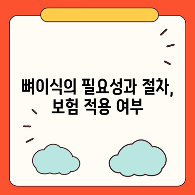 대전시 중구 대흥동 임플란트 가격 | 비용 | 부작용 | 기간 | 종류 | 뼈이식 | 보험 | 2024