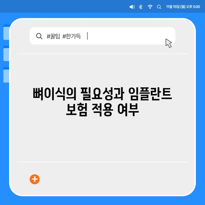 전라북도 순창군 풍산면 임플란트 가격 | 비용 | 부작용 | 기간 | 종류 | 뼈이식 | 보험 | 2024