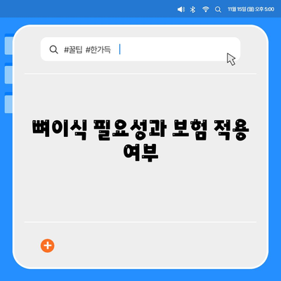 대전시 유성구 장대동 임플란트 가격 | 비용 | 부작용 | 기간 | 종류 | 뼈이식 | 보험 | 2024